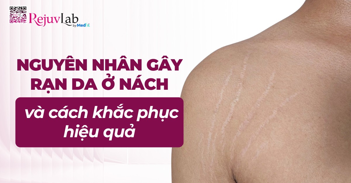 nguyên nhân gây rạn da ở nách và cách khắc phục hiệu quả