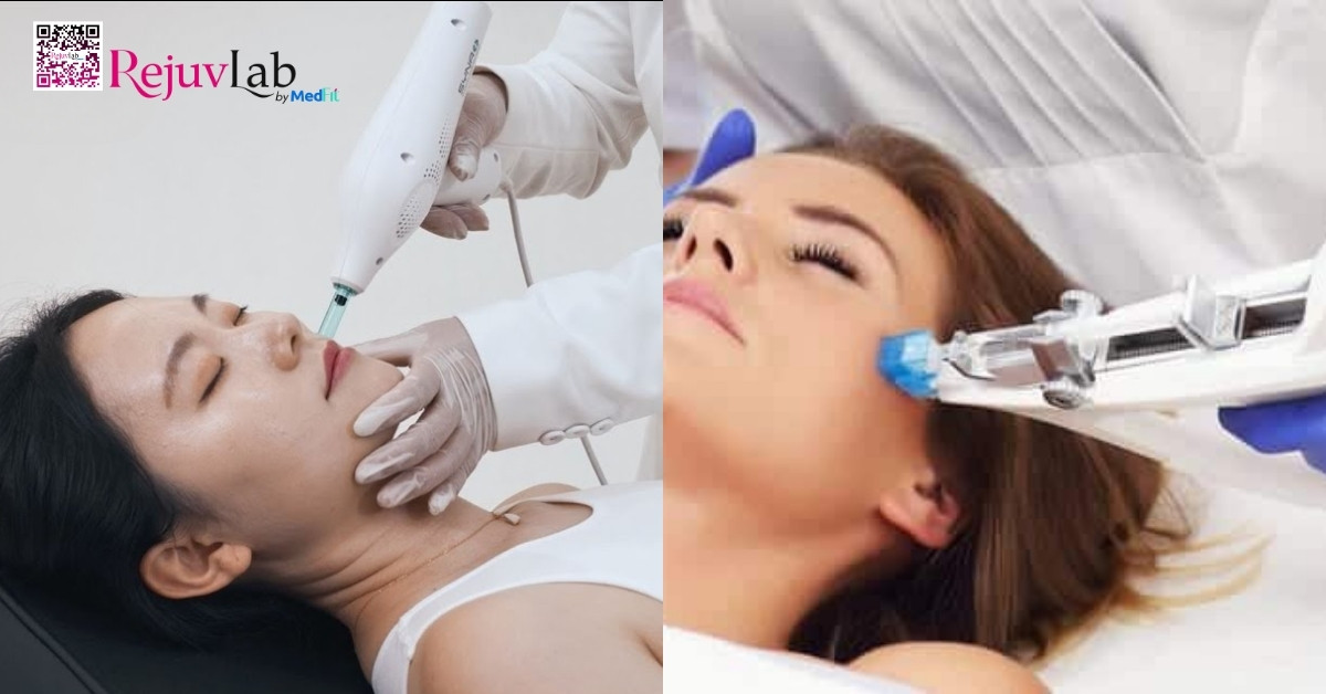 so sánh tiêm meso kim bán tự động