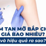 Tiêm tan mỡ bắp chân giá bao nhiêu và hiệu quả ra sao?