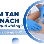 Tiêm tan mỡ nách có hiệu quả không và chi phí bao nhiêu?