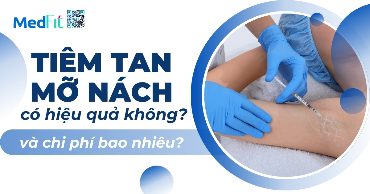 tiêm tan mỡ nách có hiệu quả không và chi phí bao nhiêu