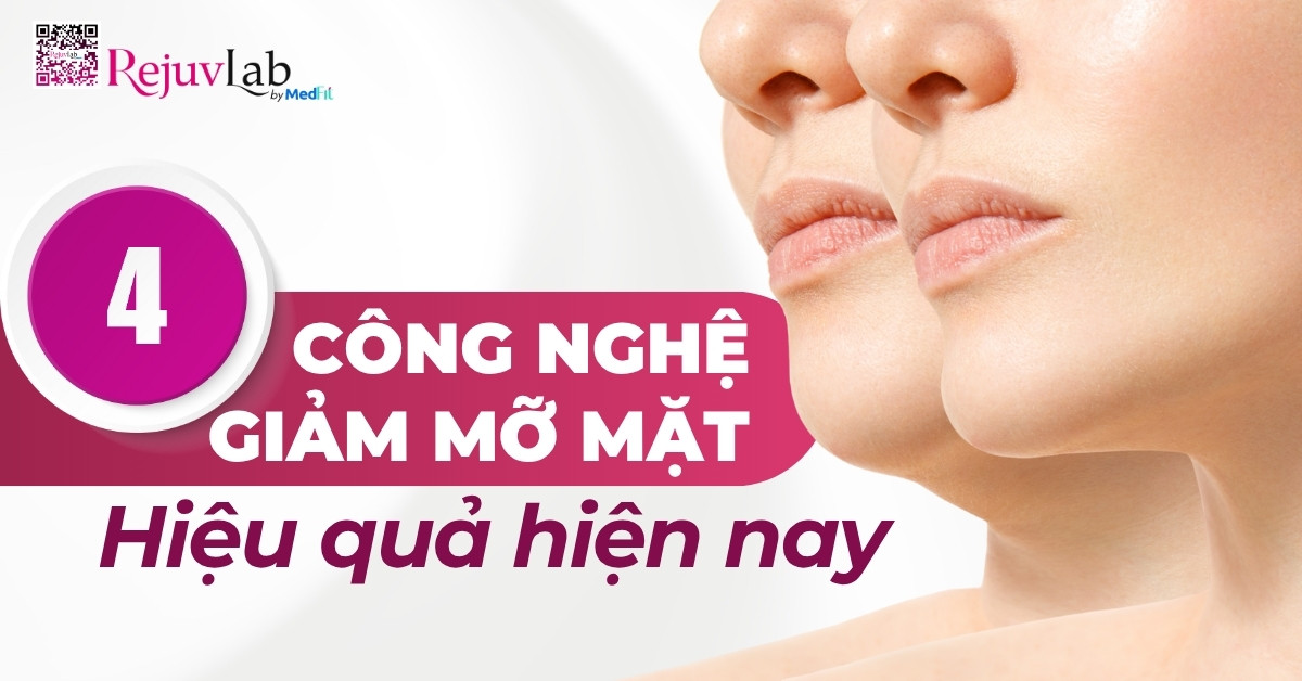 4 công nghệ giảm mỡ mặt hiệu quả hiện nay