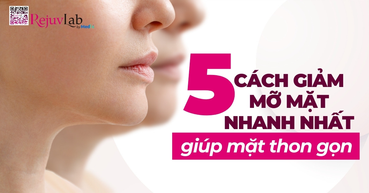 5 cách giảm mỡ mặt nhanh nhất giúp mặt thon gọn