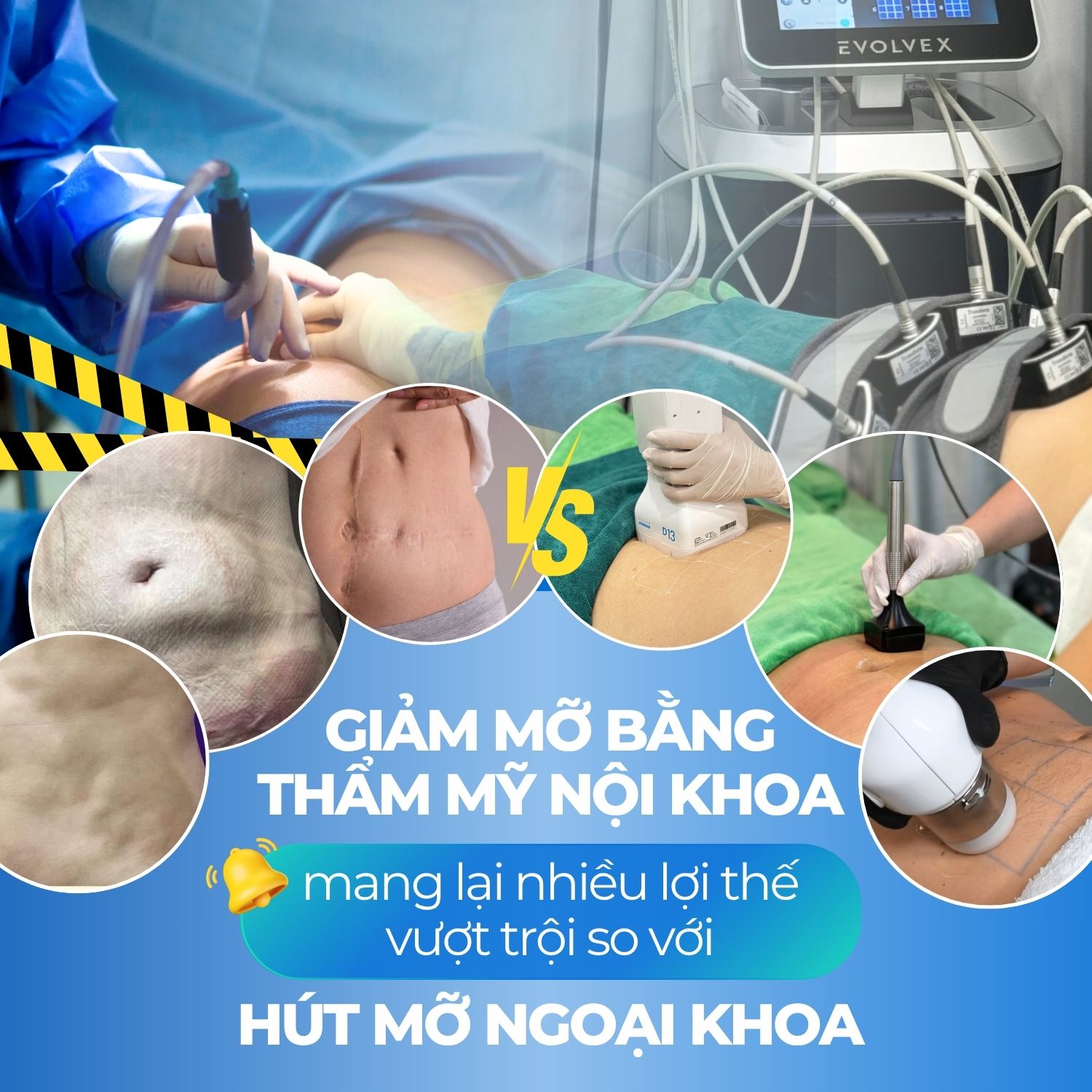 Banner warning hút mỡ - Mobile