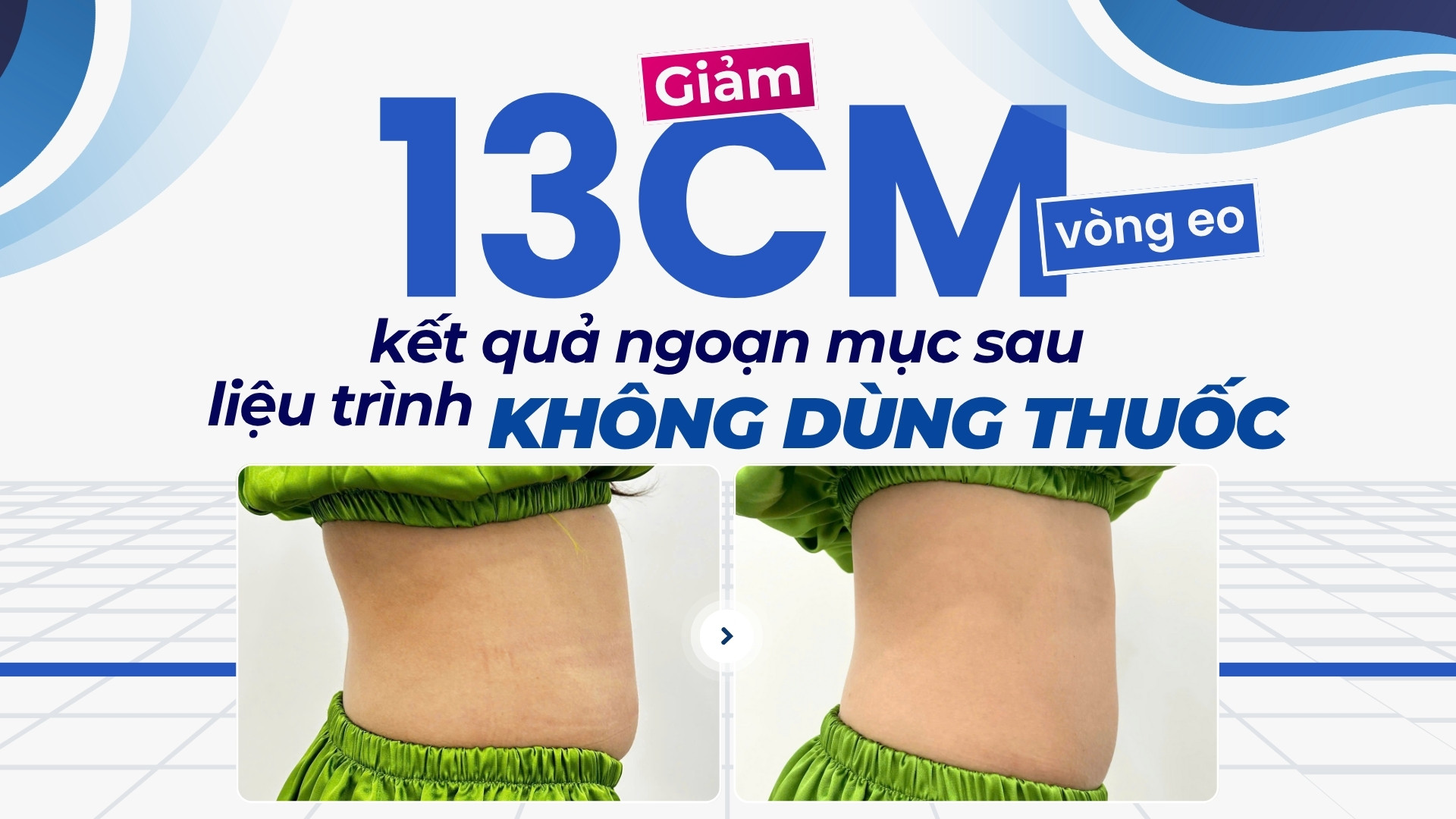 Thumb clip CLS HY