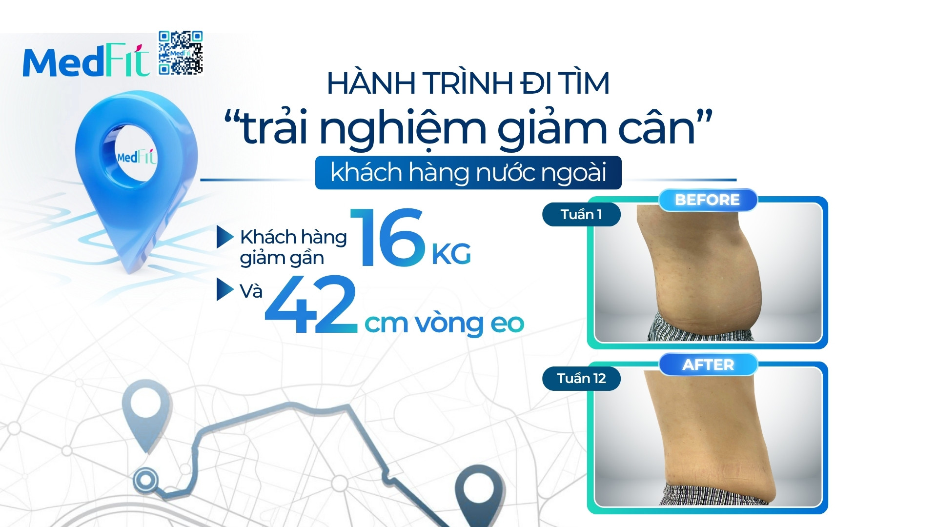 Thumb-clip-D.K
