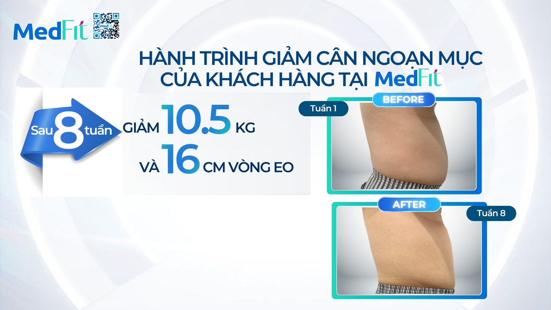 Thumb-clip-kh-T.G