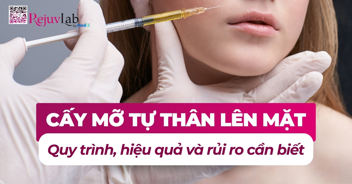 cấy mỡ tự thân lên mặt quy trình hiệu quả và rủi ro cần biết
