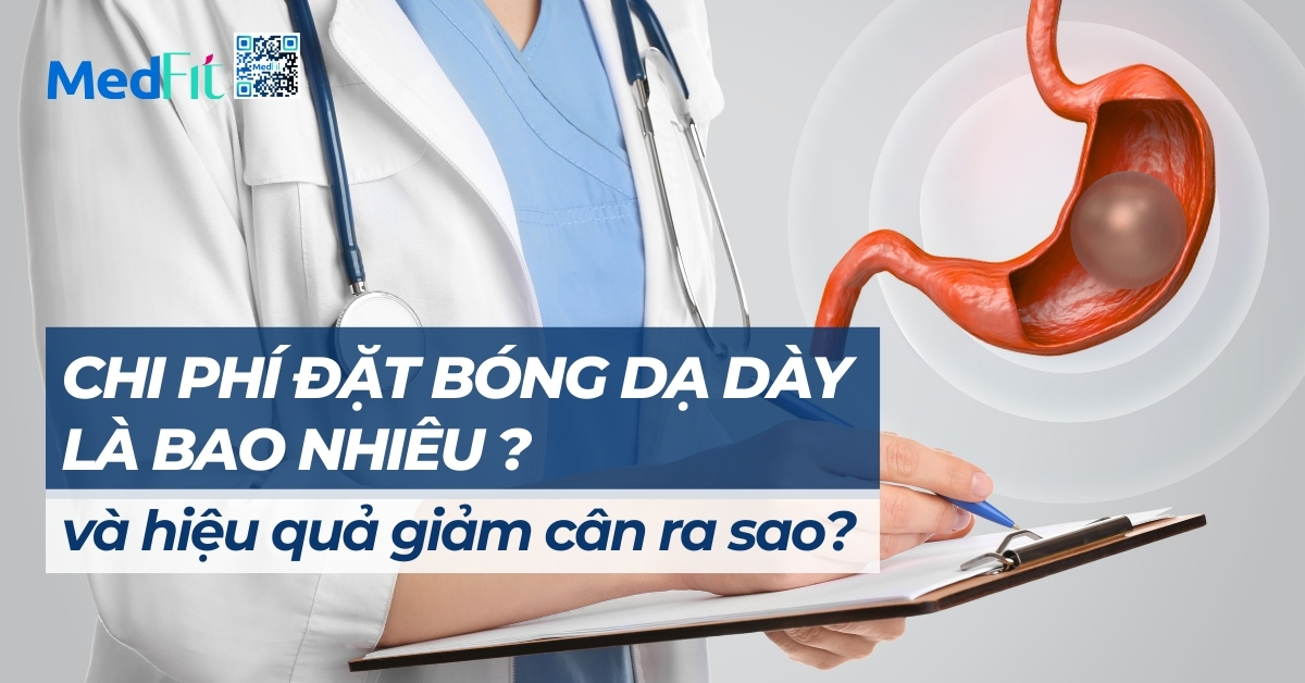 chi phí đặt bóng dạ dày là bao nhiêu và hiệu quả giảm cân ra sao