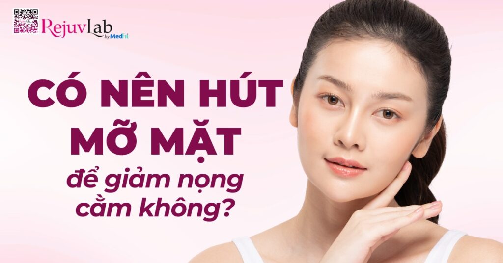 có nên hút mỡ mặt để giảm nọng cằm không