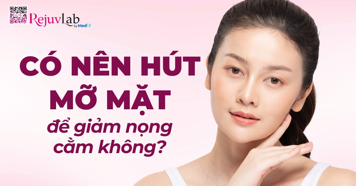 có nên hút mỡ mặt để giảm nọng cằm không
