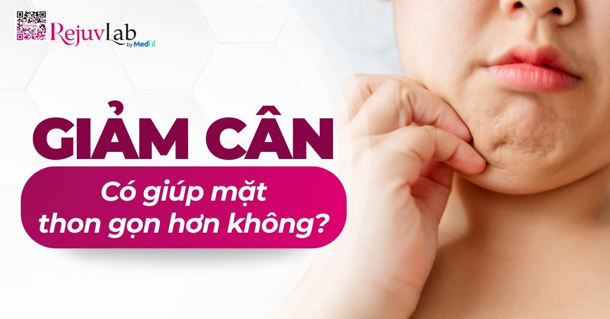 giảm cân có giúp mặt thon gọn hơn không