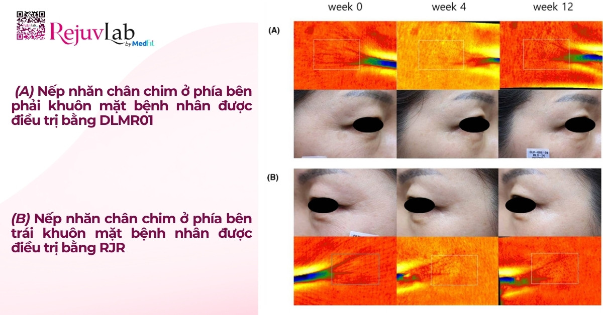 Gouri: Chất kích thích sinh học PCL thế hệ mới 3 hiệu quả của gouri qua nghiên cứu