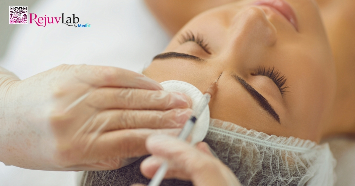 Cấy mỡ mặt giá bao nhiêu và hiệu quả bao lâu? 5 hình minh họa tiêm filler