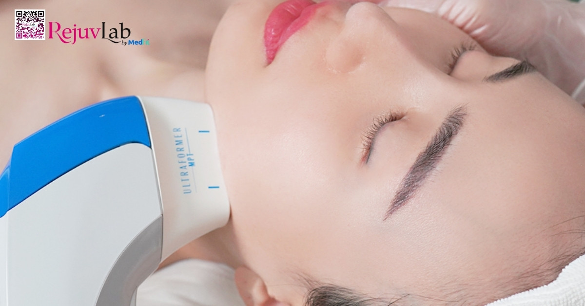 hình minh họa ultraformer mặt