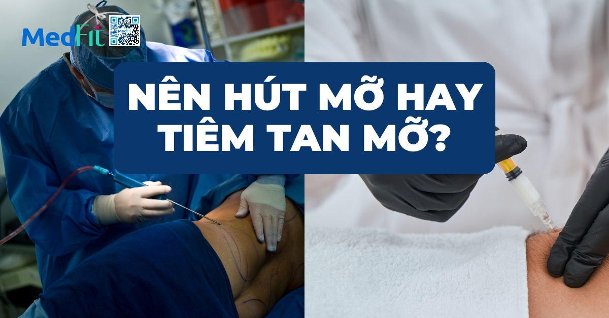 nên hút mỡ hay tiêm tan mỡ