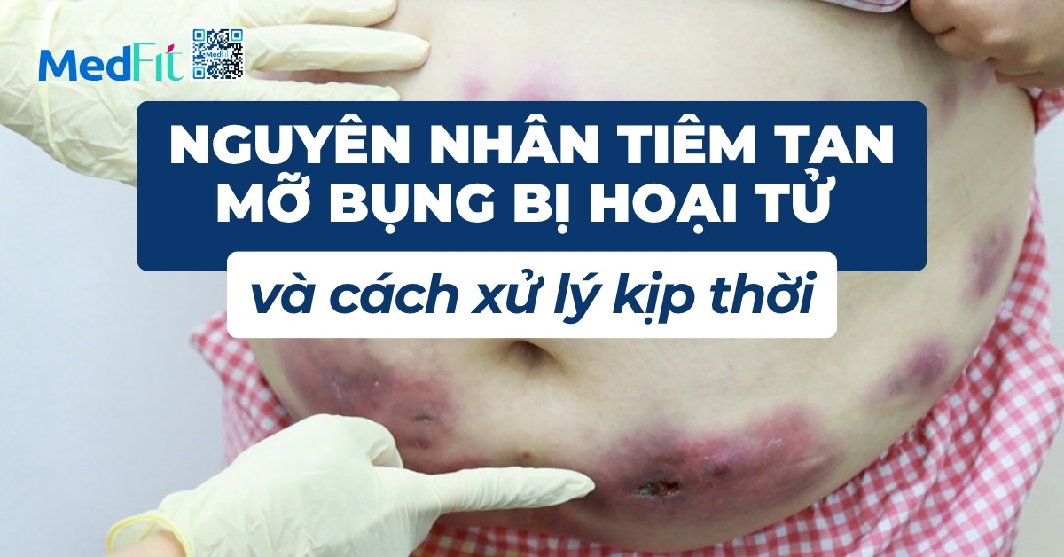 nguyên nhân tiêm tan mỡ bụng bị hoại tử và cách xử lý kịp thời