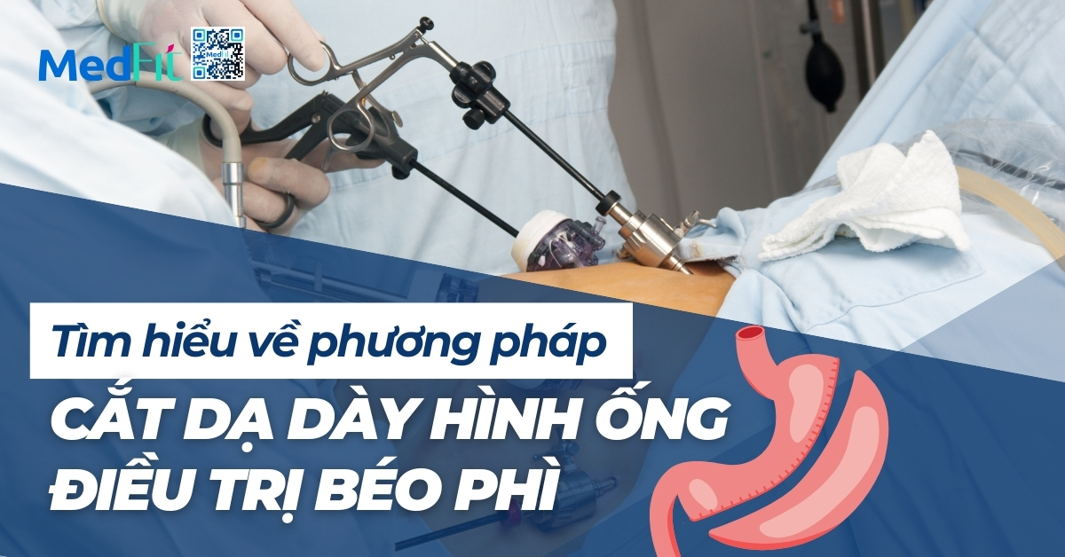 tìm hiểu vè phương pháp cắt dạ dày hình ống điều trị béo phì
