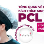 Tổng quan về chất kích thích sinh học PCL trong da liễu thẩm mỹ