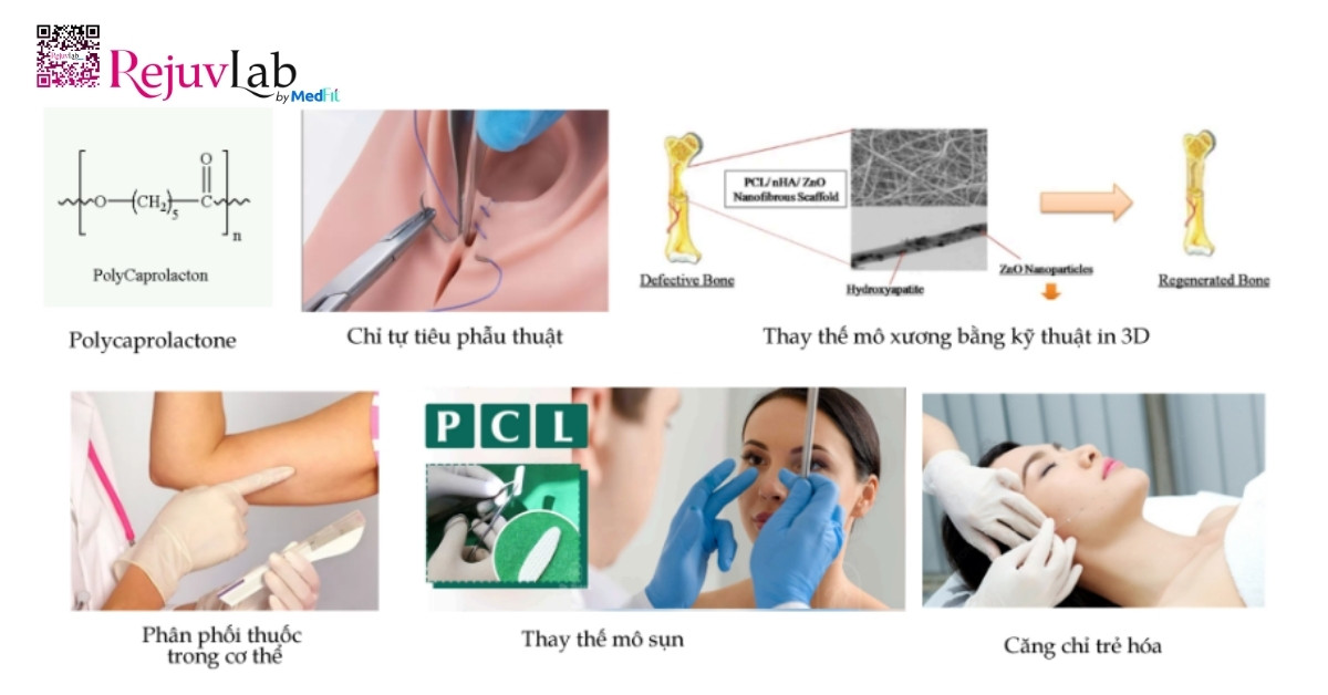 Tổng quan về chất kích thích sinh học PCL trong da liễu thẩm mỹ 2 ứng dụng của pcl