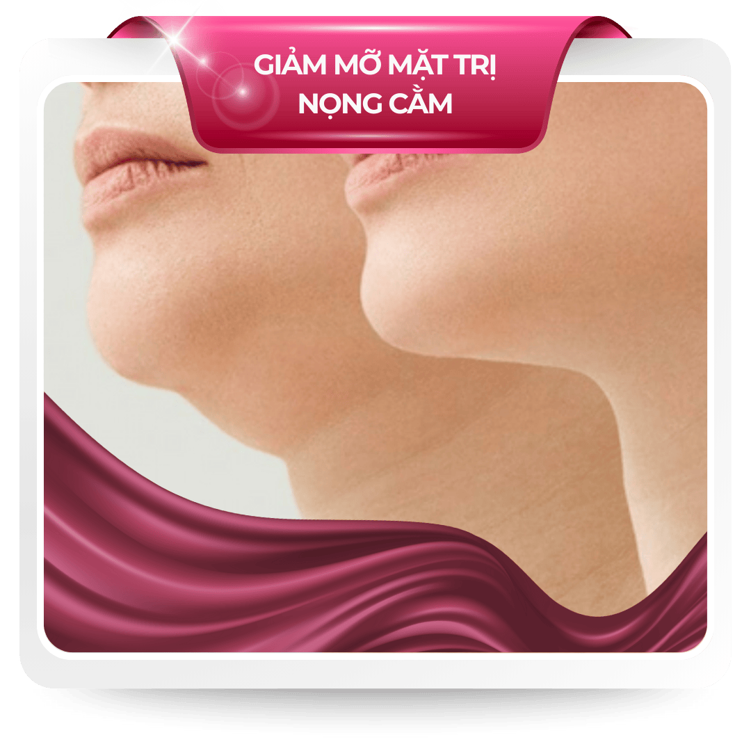 Giảm mỡ mặt trị nọng cằm