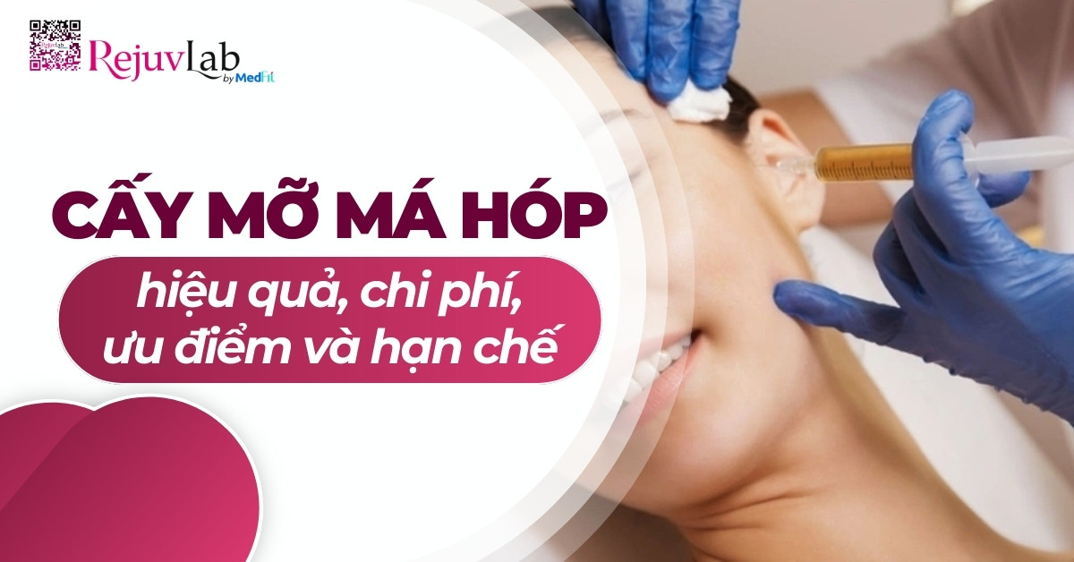 cấy mỡ má hóp hiệu quả ưu điểm chi phí và hạn chế