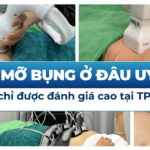 Giảm mỡ bụng ở đâu uy tín? 4 địa chỉ được đánh giá cao tại TP. HCM