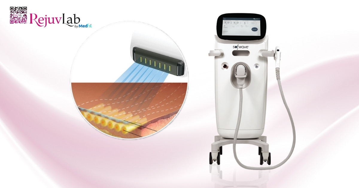 Sofwave là gì và ứng dụng trong nâng cơ, trẻ hóa da 2 hình minh họa công nghệ superb
