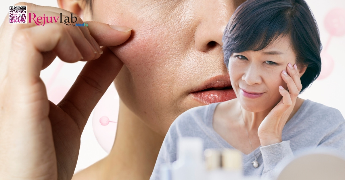 Liệu trình trẻ hóa da mặt giá bao nhiêu? Bảng giá các phương pháp phổ biến 4 hình minh họa da lão hóa