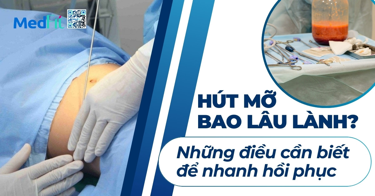 hút mỡ bao lâu lành
