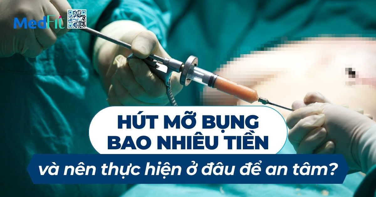 hút mỡ bụng bao nhiêu tiền