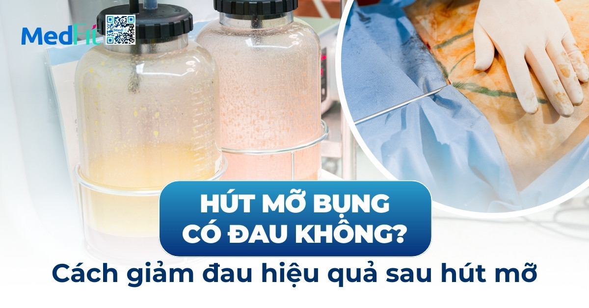 hút mỡ bụng có đau không