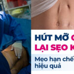 Hút mỡ bao lâu lành? Những điều cần biết để nhanh hồi phục 6 Hút mỡ có để lại sẹo không? Mẹo hạn chế sẹo hiệu quả