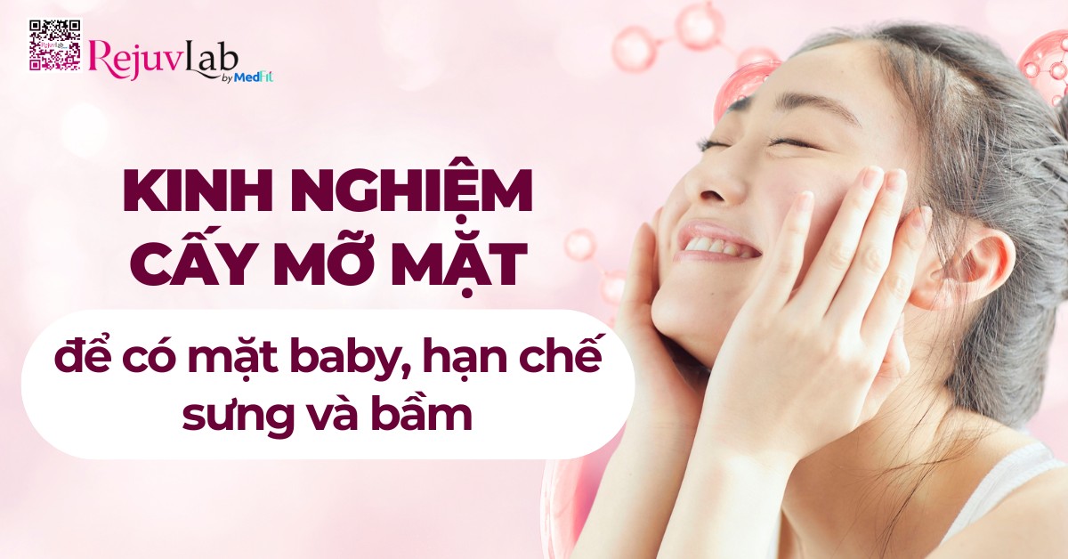 kinh nghiệm cấy mỡ mặt để có mặt baby