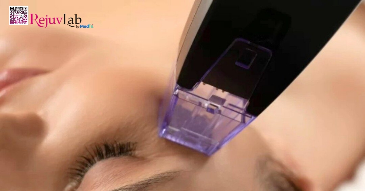 liệu pháp công nghệ cao vùng mắt