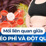 Mối liên quan giữa béo phì và ung thư 2 Mối liên quan giữa béo phì và đột quỵ