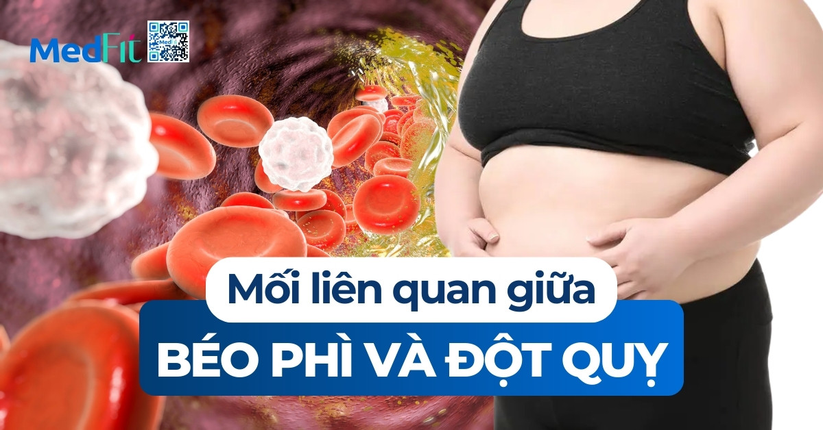 mối liên quan giữa béo phì và đột quỵ