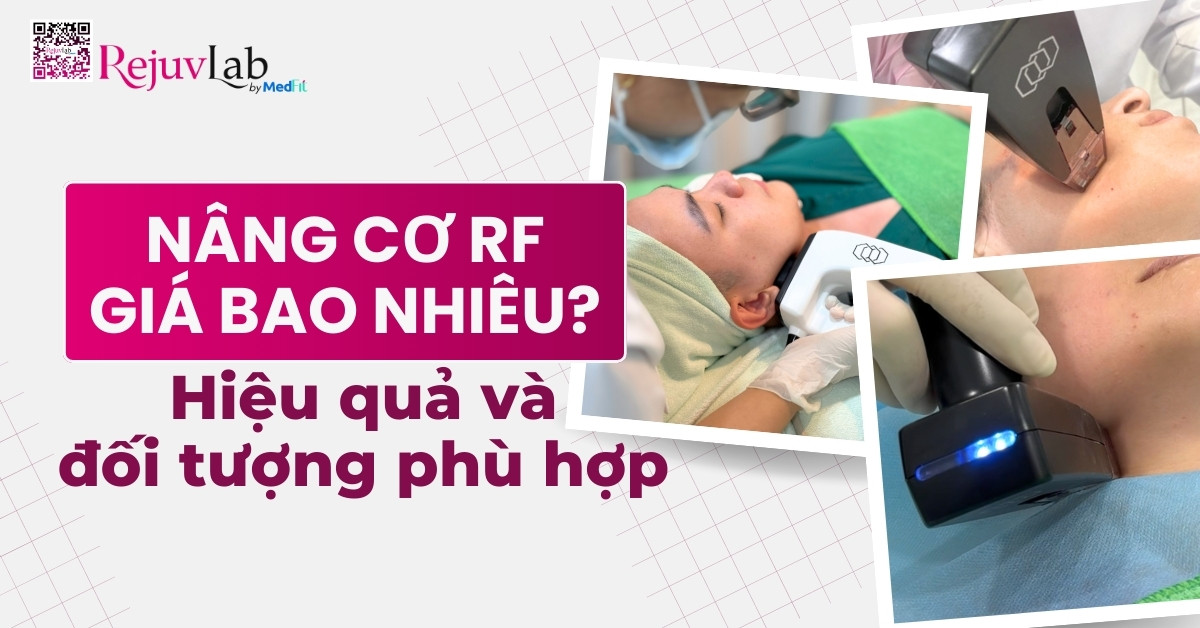 nâng cơ rf giá bao nhiêu