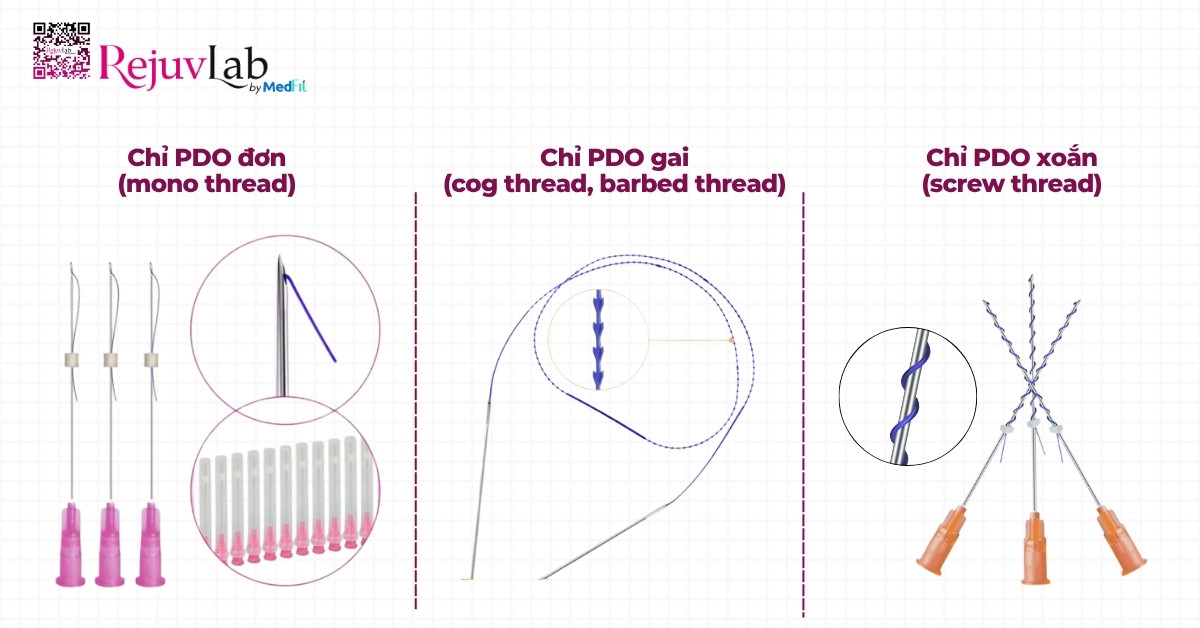 Tổng quan về chất kích thích sinh học PDO trong da liễu thẩm mỹ 3 phân loại các loại chỉ pdo