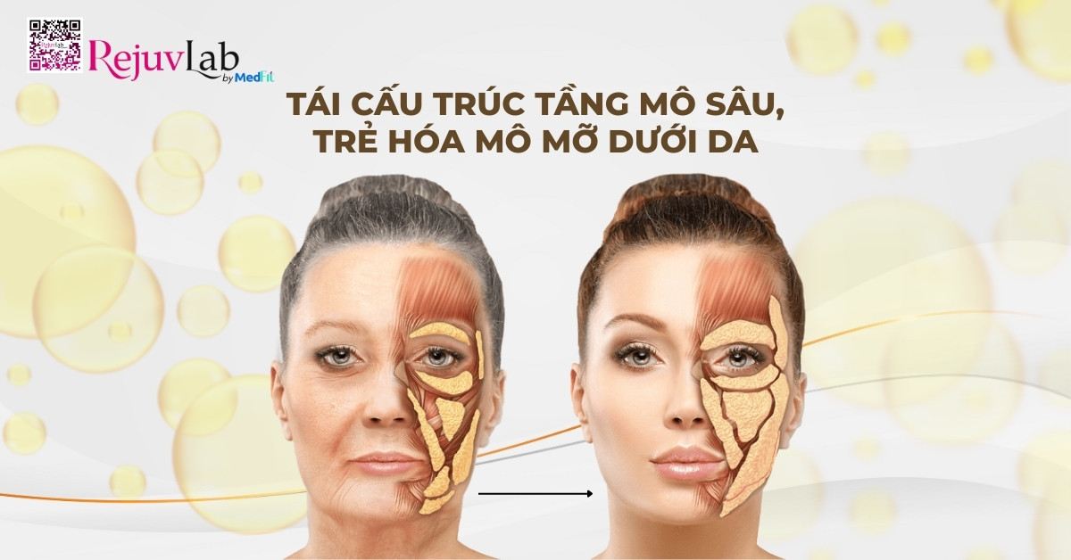 profhilo structura tái cấu trúc tầng mô