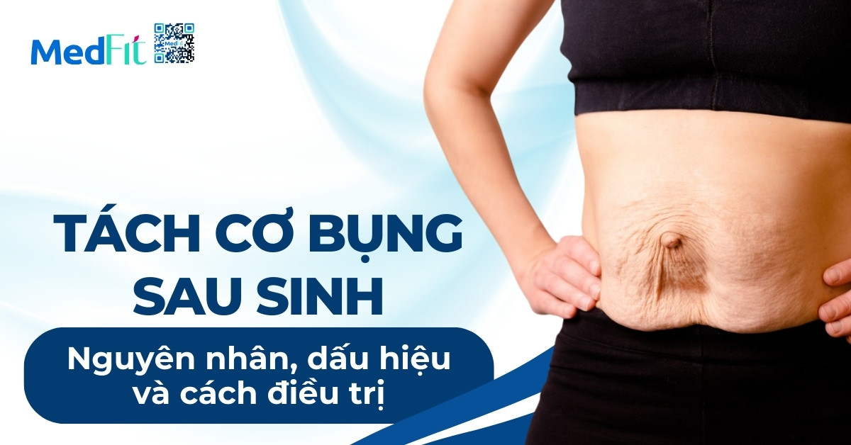 tách cơ bụng sau sinh nguyên nhân dấu hiệu và cách điều triij