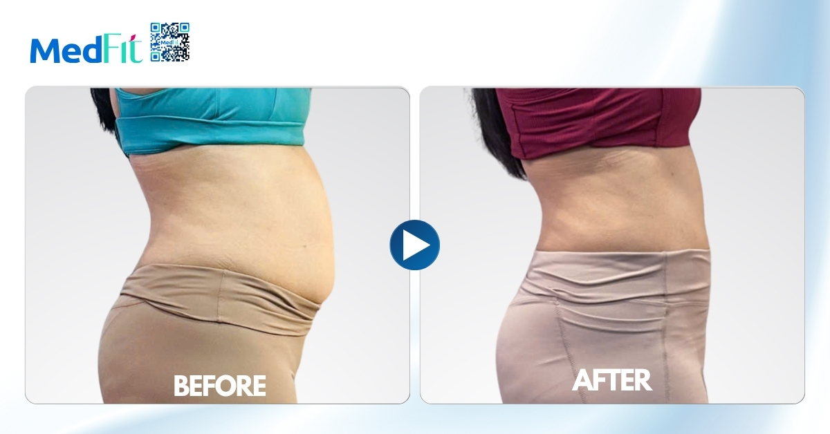BA hình chụp body khách hàng