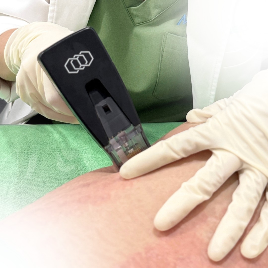 Bước 3 - điều trị Bước 3 - điều trị