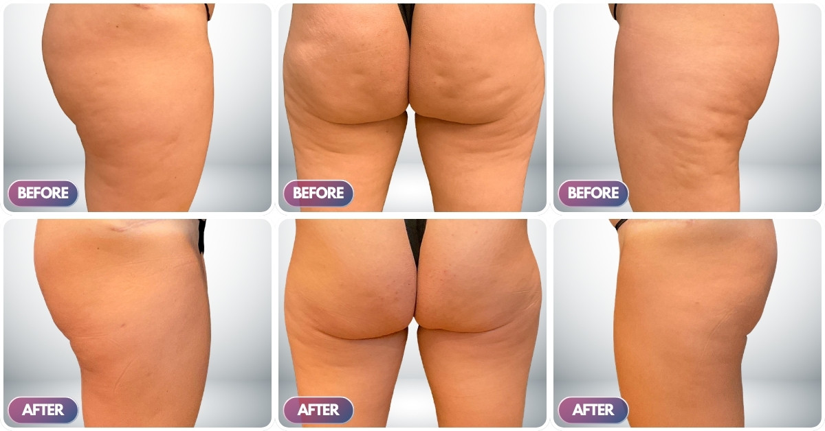 Ca lầm sàng số 1 Ca lầm sàng số 1