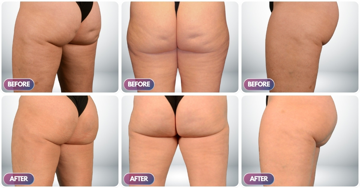 Ca lầm sàng số 2 Ca lầm sàng số 2