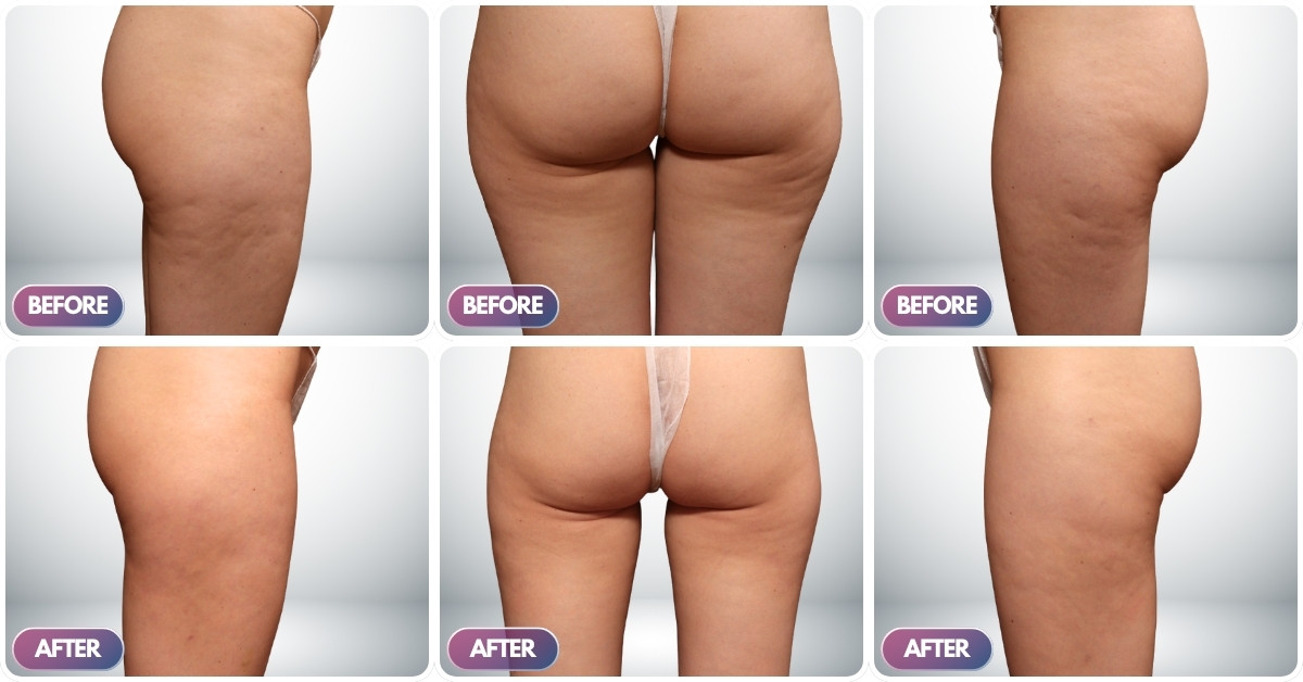 Ca lâm sàng số 3 Ca lâm sàng số 3