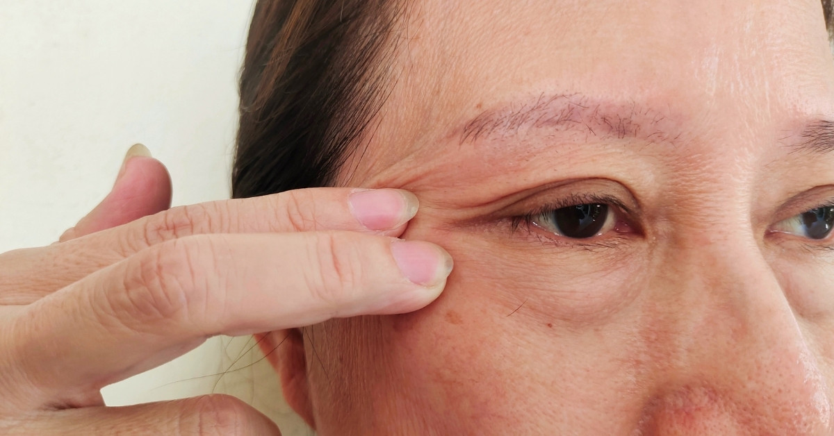 Da chùn nhão mất độ săn chắc