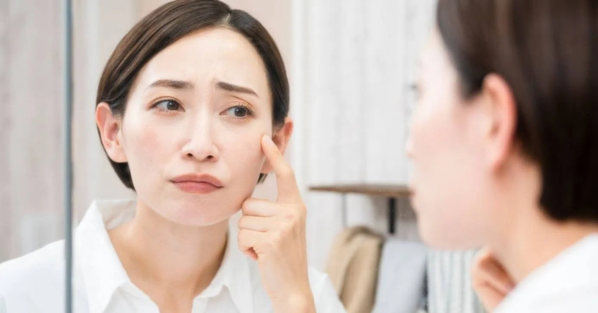 Da mỏng yếu, khô, thiếu ẩm và thô ráp