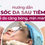 Tiêm meso phục hồi da và những lợi ích bất ngờ cho làn da mỏng yếu 17 Hướng dẫn chăm sóc da sau tiêm meso để da căng bóng, mịn màng