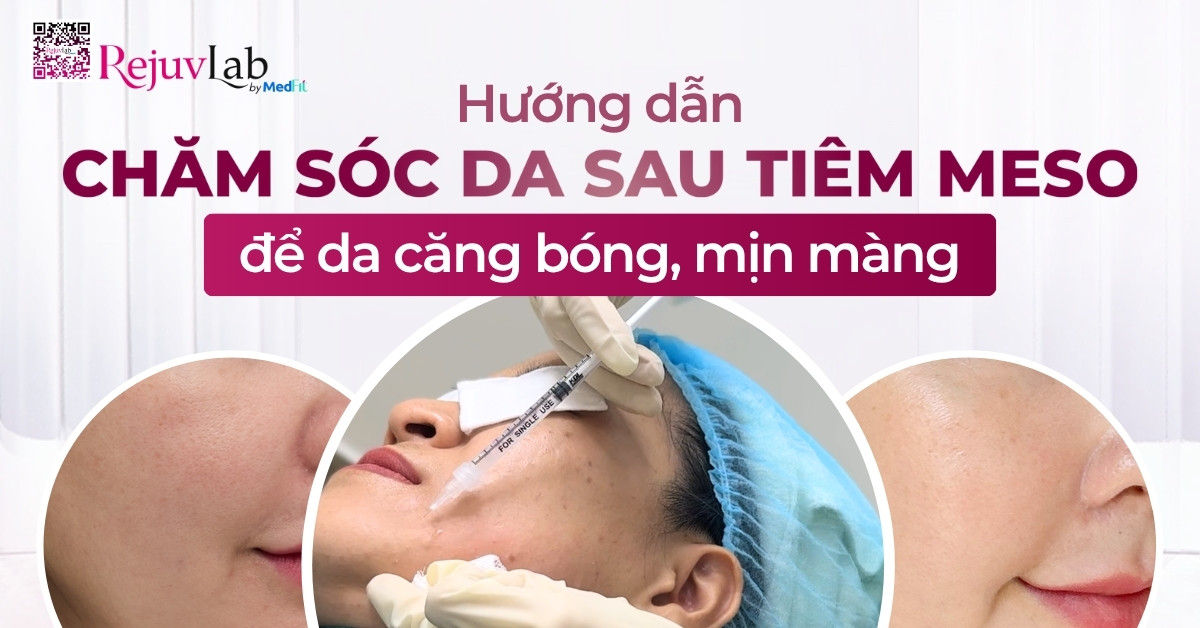 Hướng dẫn chăm sóc da sau tiêm meso để da căng bóng, mịn màng Hướng dẫn chăm sóc da sau tiêm meso để da căng bóng, mịn màng